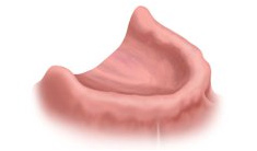 Full Arch Replacement dental implants
