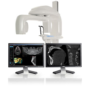 advanced cone beam imaging