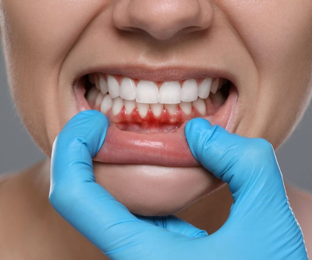 allograft vs autograft